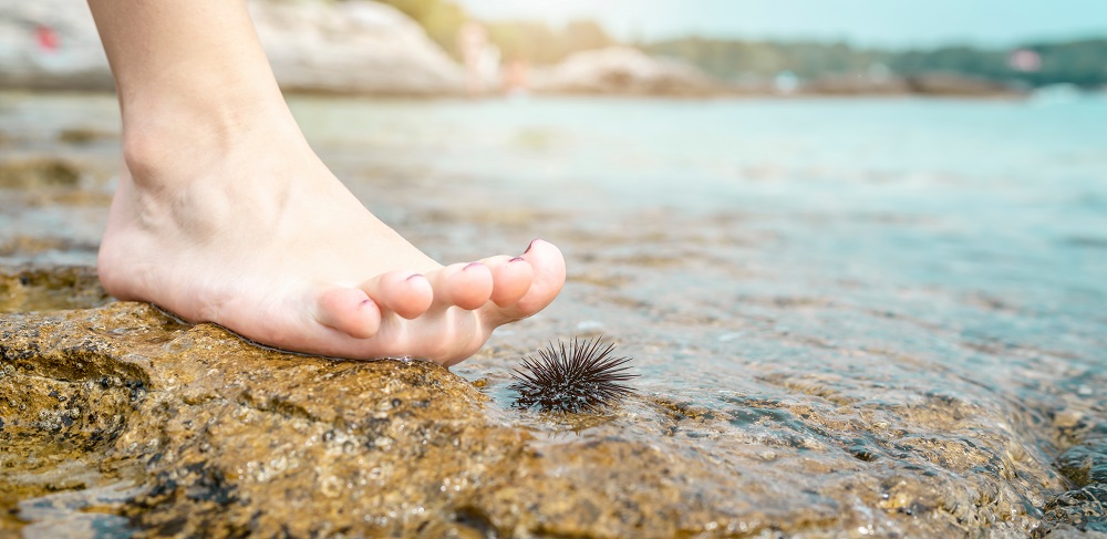 Frau die im Urlaub fast auf einen Seeigel tritt